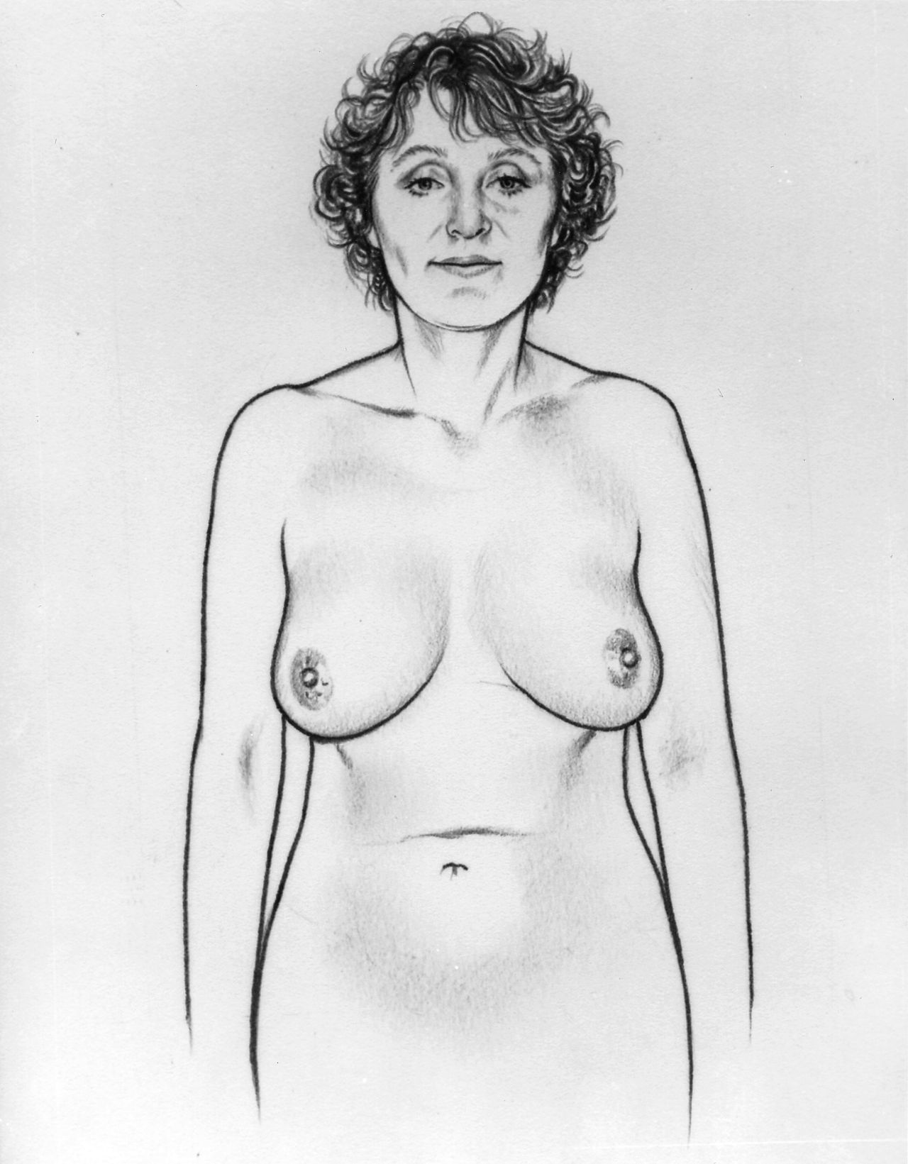 Breast Cancer Symptoms and How to Do a Self-Exam at Home