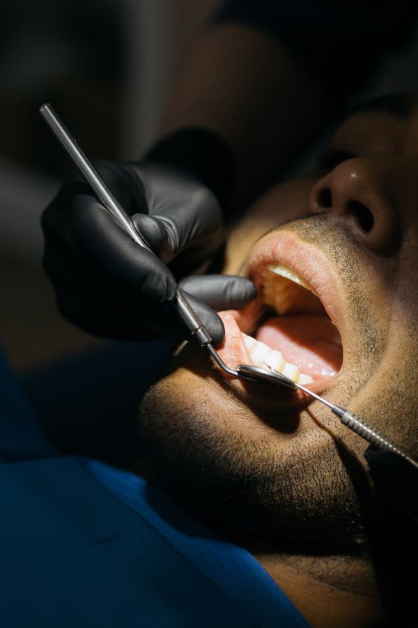 Dental Tartar: Dangers and How Scaling Removes It